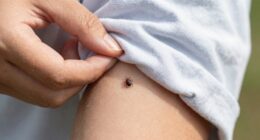 tick habitats and removal