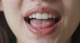 breath drool chewing clues