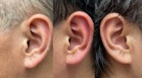 ear hygiene for different ears