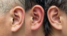 ear hygiene for different ears